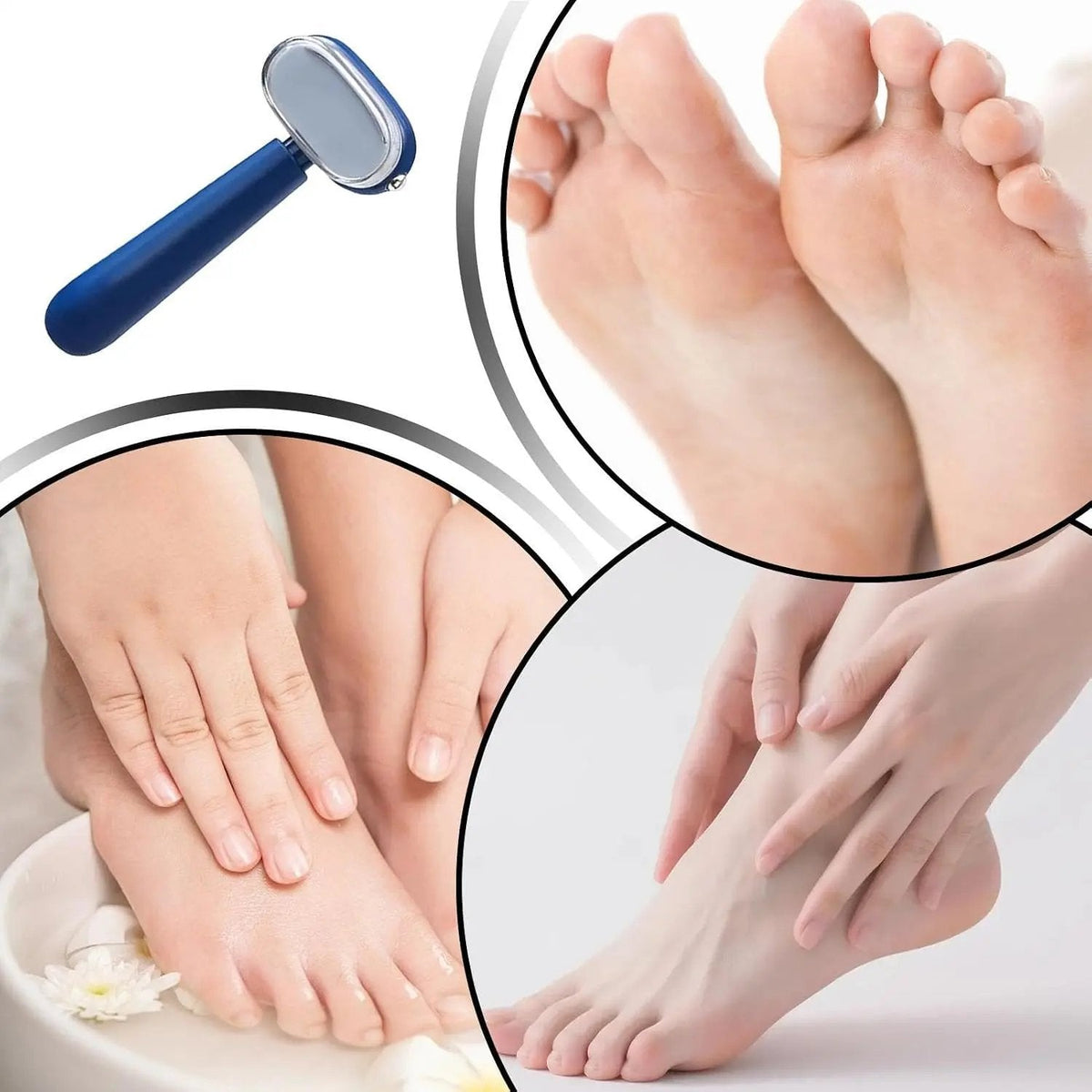 Dual-Sided Foot Callus Remover